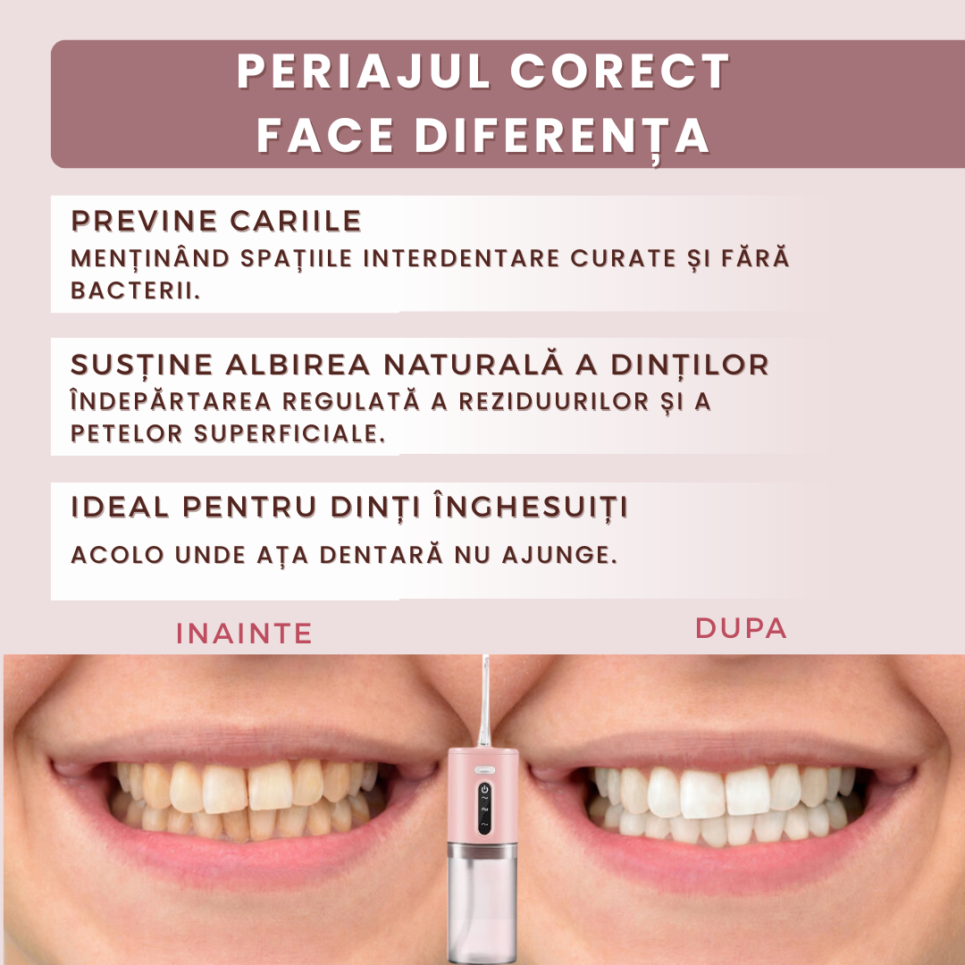 Dus Bucal CURATARE INTEGRALA